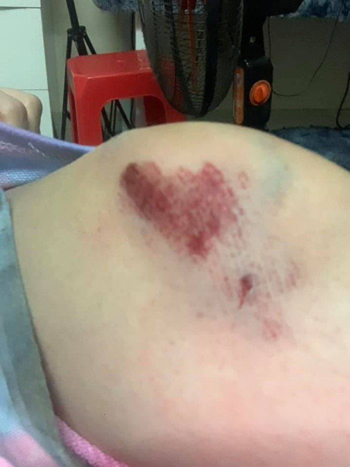 Nữ DJ bị cướp 'kéo lê' 3m trên đường bức xúc lên tiếng khi dân mạng 'soi mói' ngoại hình Ảnh 4