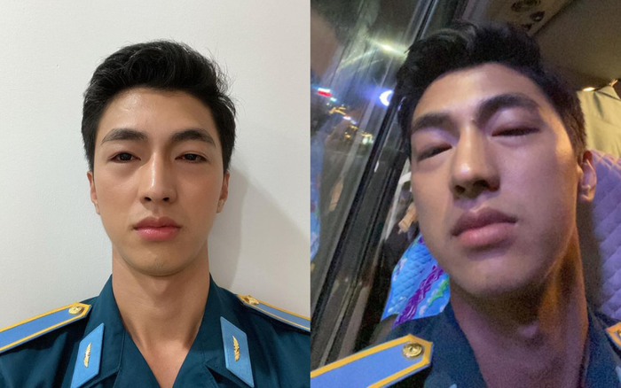 Bình An đăng ảnh mắt sưng húp và mặt biến đổi gây lo lắng, dàn sao Việt đồng loạt gửi lời hỏi thăm Ảnh 2