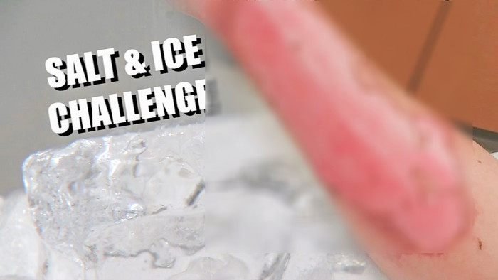 Thử thách tưởng chừng vô hại này có thể gây bỏng lạnh khiến cơ thể những người tham gia chịu thương tật vĩnh viễn. (Ảnh: KCRG)