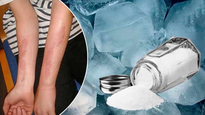 Thử thách này vẫn được một số người trẻ rỉ tai nhau thực hiện, đặt người tham gia vào nguy cơ bị bỏng nặng mà không hề biết. (Ảnh: Internet)