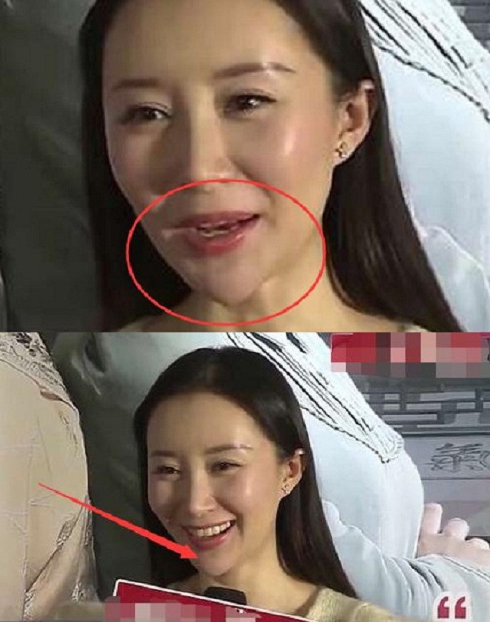 Thư Sướng vướng nghi vấn phẫu thuật thẩm mỹ nhưng cô đã phủ nhận.