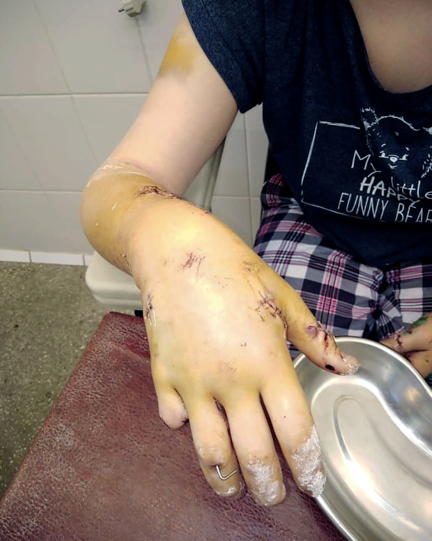 Cánh tay không thể khôi phục lại của cô Pavlova