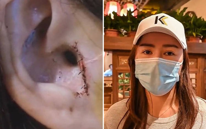 Phẫu thuật nâng mũi, cô gái 'chết đứng người' khi phát hiện sự thật Ảnh 2