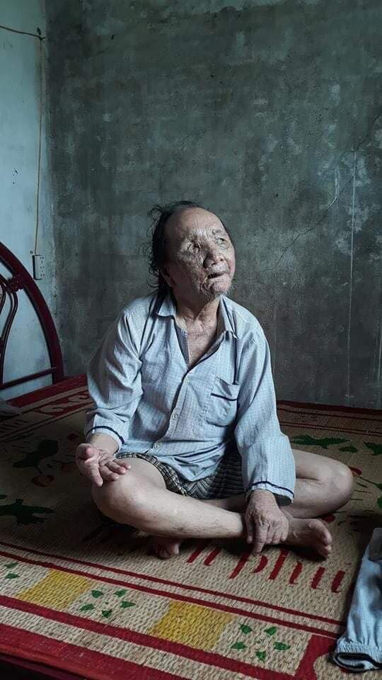 Một hoàn cảnh khó khăn