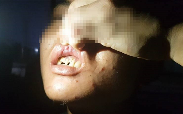 Tạm giữ hình sự nữ chủ quán bánh xèo nghi bỏ đói, đánh đập dã man 2 nhân viên giúp việc Ảnh 2