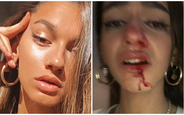 Cô gái chuyển giới bị hành hung và gọi là 'đồ quái vật' Ảnh 2