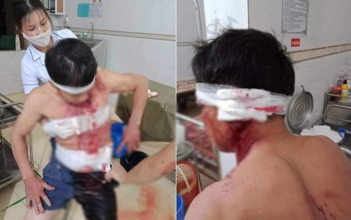 Điều tra vụ nhóm đối tượng xông vào nhà đánh người trọng thương Ảnh 2