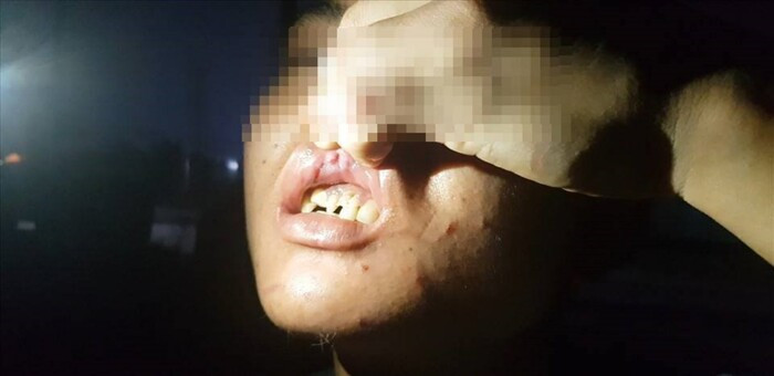 Nhân viên tố thường xuyên bị chủ quán bạo hành. Ảnh Báo Lao Động