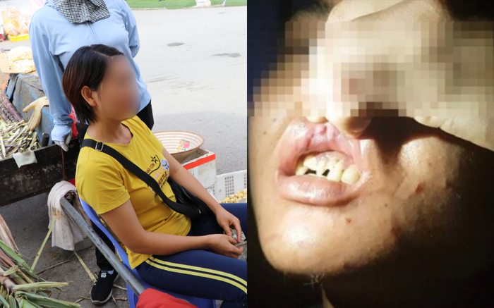 Nữ chủ quán bánh xèo nghi bỏ đói, đánh đập dã man 2 nhân viên: Những lần bắt xe ôm 'trốn chạy' trong đêm Ảnh 2