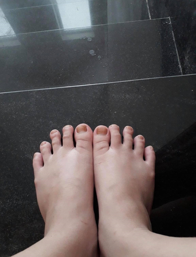 Tân Hoa hậu Đỗ Thị Hà tự 'bốc' khuyết điểm trên cơ thể trước khi đăng quang, đó là đôi bàn chân thô kệch với bộ móng vàng vọt kém xinh