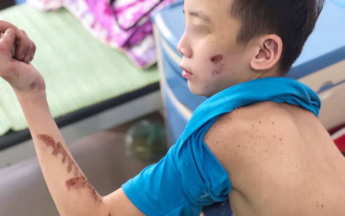 Nhân viên 15 tuổi kể chuỗi ngày bị chủ quán bánh xèo tra tấn: Nằm ngủ nền đất, ăn đồ thừa của khách Ảnh 2