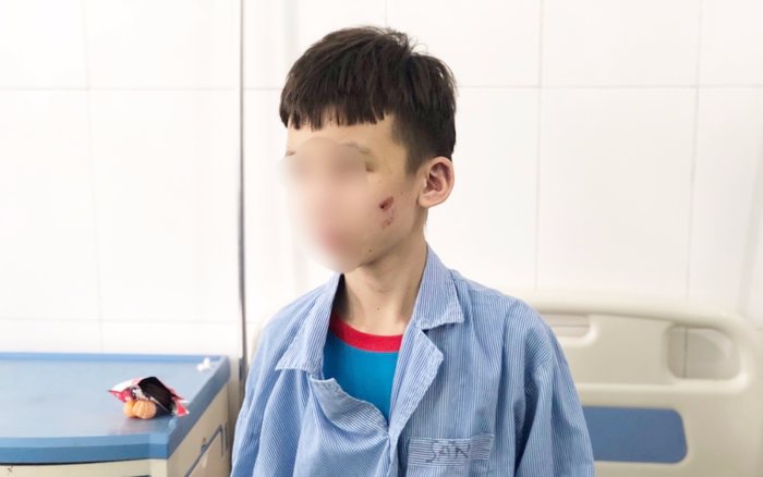 Nhân viên 15 tuổi bị chủ quán bánh xèo đánh đập dã man: 'Em kể với anh trai nhưng lại bị anh chửi' Ảnh 2