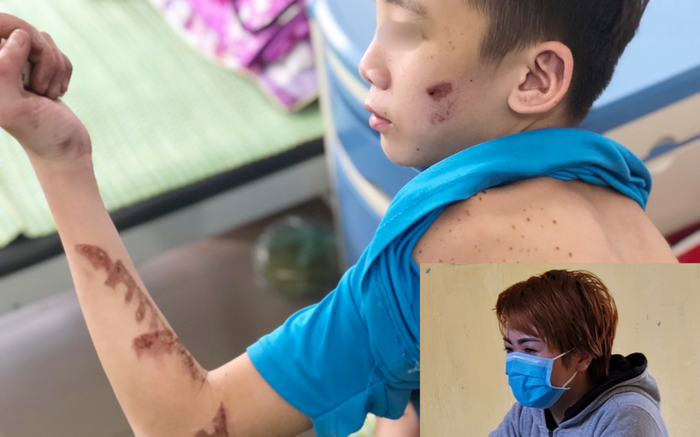 Chủ quán bánh xèo cầm bàn chải đánh vẩy cá đánh thương tích nhân viên có thể bị phạt tù Ảnh 2