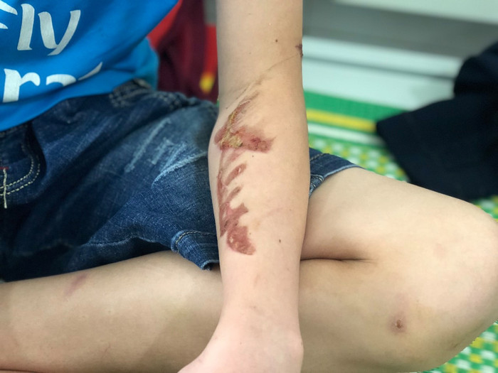 Gia cảnh khốn cùng của cậu bé 15 tuổi bị chủ quán bánh xèo đánh đập dã man Ảnh 4