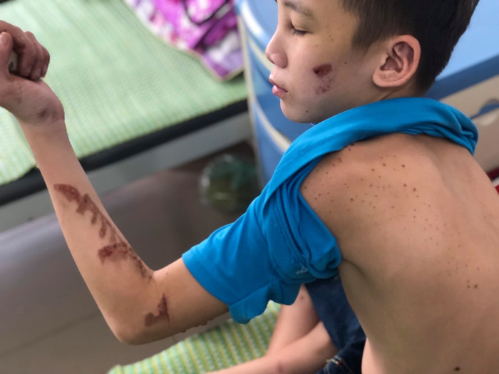 Gia cảnh khốn cùng của cậu bé 15 tuổi bị chủ quán bánh xèo đánh đập dã man Ảnh 5