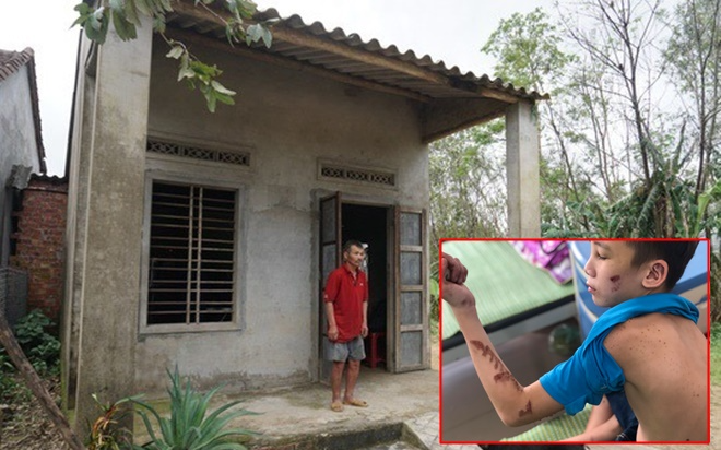 Gia cảnh khốn cùng của cậu bé 15 tuổi bị chủ quán bánh xèo đánh đập dã man Ảnh 2