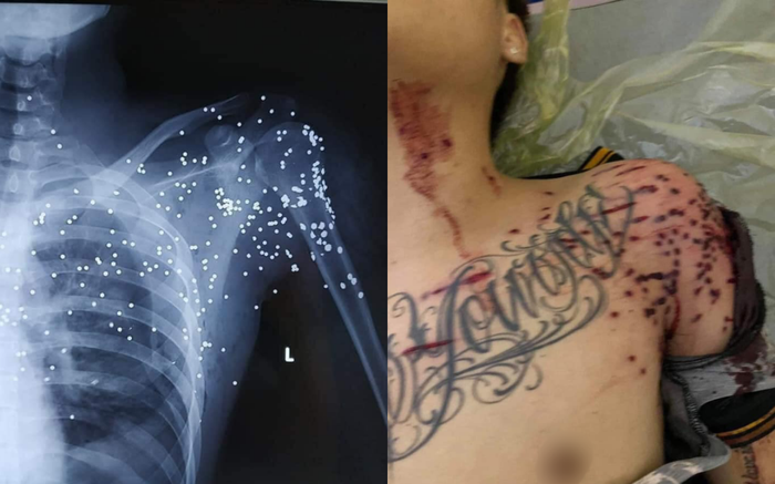 Khởi tố kẻ dùng súng hoa cải bắn nam thanh niên nguy kịch ở trạm thu phí Ảnh 2