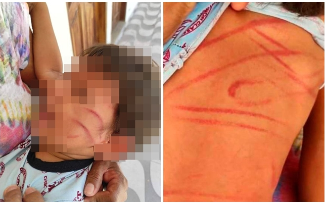 Xót xa hình ảnh bé trai 2 tuổi bị đánh dã man, mặt, lưng và khắp cơ thể rỉ máu Ảnh 2