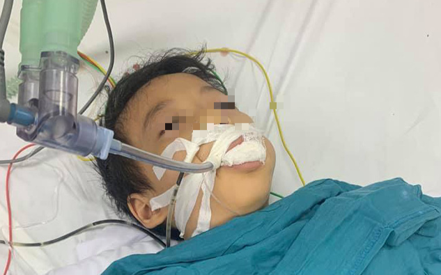 Ăn nhầm thuốc diệt chuột có hình viên kẹo, một học sinh lớp 1 nguy kịch Ảnh 2