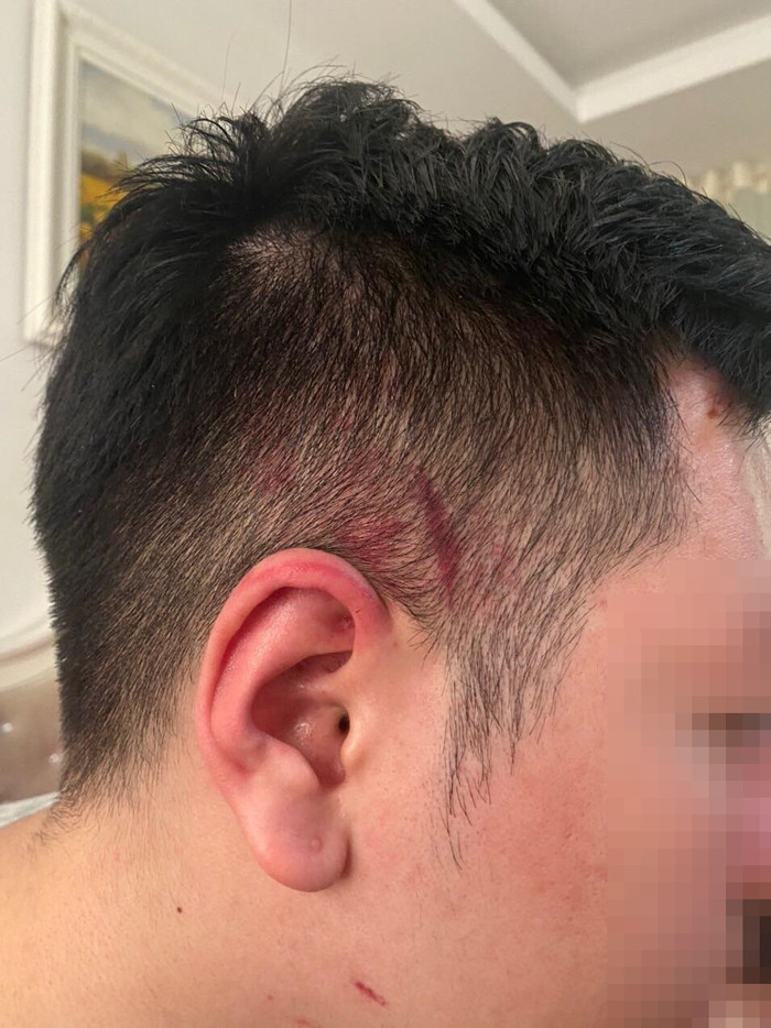 Nhóm nhân viên quán bar xông vào hành hung khi anh T. đứng ra can ngăn.