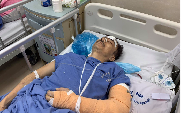 Người đàn ông rơi từ thang máy chung cư tầng 2 xuống đất đang hôn mê, tay chân bị gãy Ảnh 2