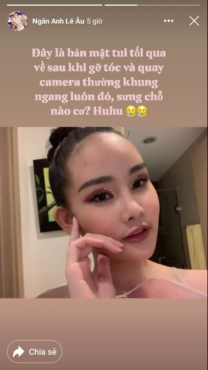 Lê Âu Ngân Anh quay clip chứng minh mặt không hề sưng như lời của cư dân mạng
