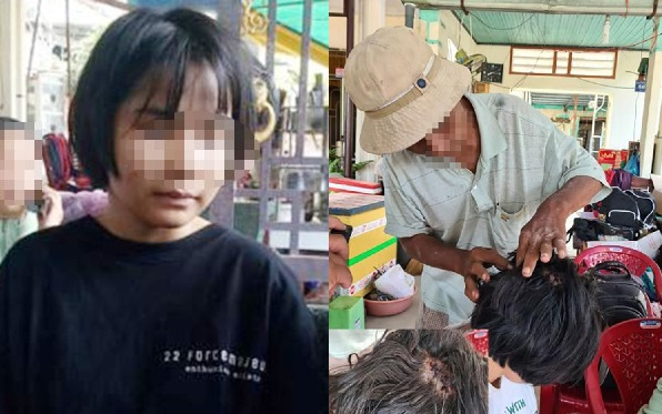 Vụ nữ sinh bị đá liên tiếp sau va chạm giao thông: 'Em vừa ngẩng đầu lên liền bị chân đạp thẳng vào mặt' Ảnh 2