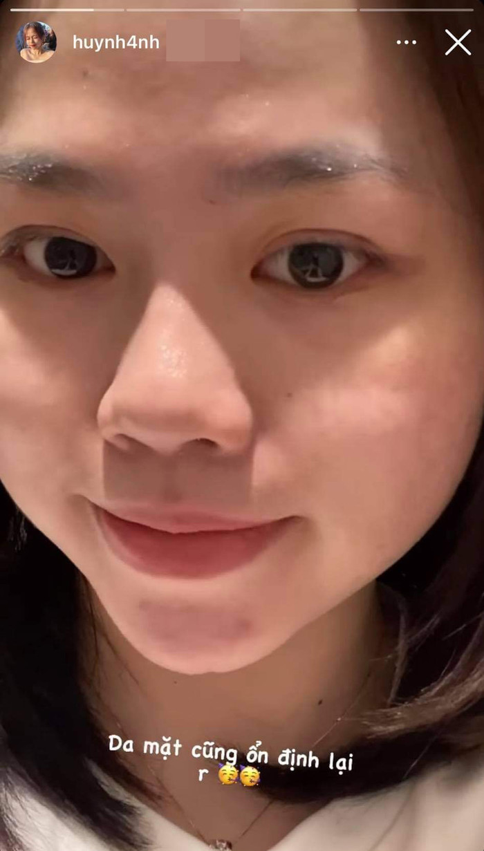 Cận cảnh gương mặt mộc xinh xắn của Huỳnh Anh