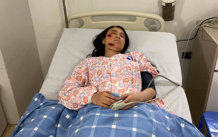 Sau phát ngôn phản cảm về sự ra đi của cố nghệ sĩ Chí Tài, hotgirl Linh Miu đăng ảnh đầy thương tích Ảnh 2