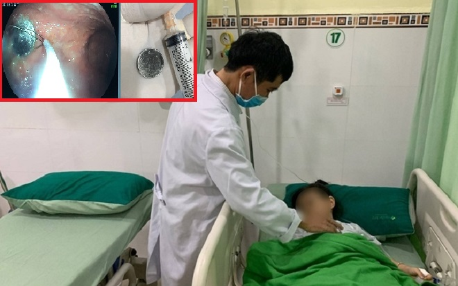 Mãi mê chơi đùa, bé gái 4 tuổi nuốt đồng xu phải nhập viện cấp cứu Ảnh 2