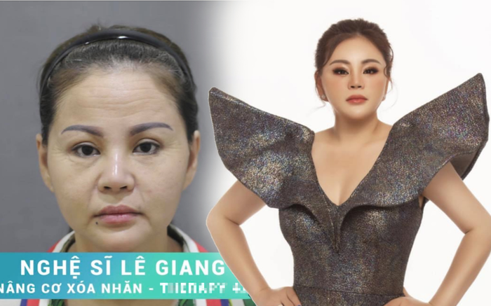 Lê Giang bức xúc khi bị người khác lấy ảnh mặt mộc kém sắc quảng cáo trái phép Ảnh 2