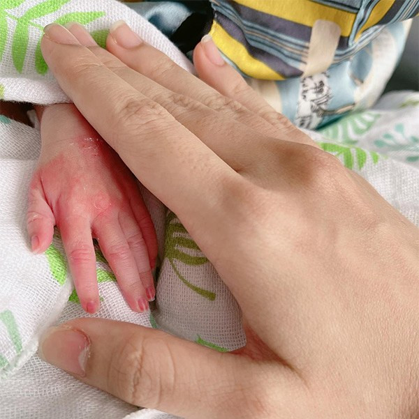 Hình ảnh bàn tay em bé sinh non nhỏ xíu bên cạnh tay mẹ khiến ai nấy nhìn thấy đều thương vô cùng.