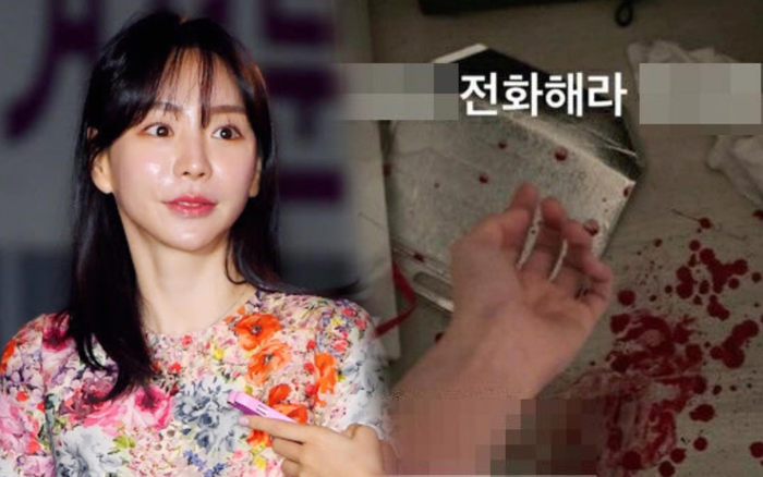 Bồ cũ Park Yoochun cắt tay tự tử: Sàn nhà nhuốm màu máu đỏ thẫm! Ảnh 2