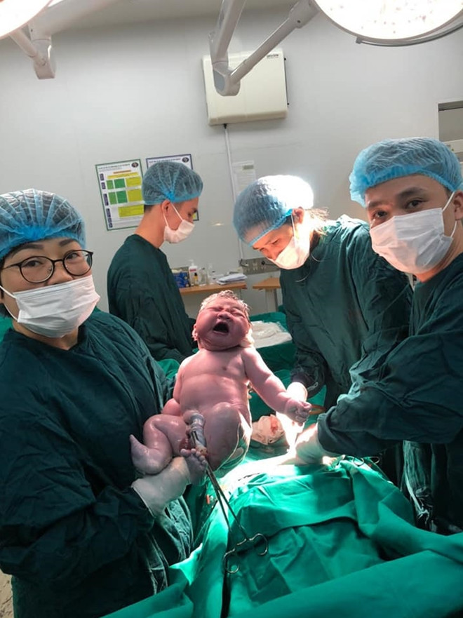 Các bác sĩ Khoa Ngoại sản - Bệnh viện Bệnh Nhiệt đới Trương ương mổ bắt con thành công cho sản phụ 40 tuổi. Ảnh: CAND