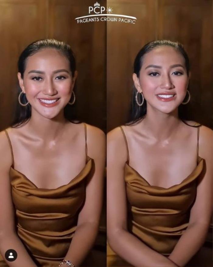 Đối thủ Khánh Vân bị nghi kéo cằm, gọt xương quai hàm, nhuộm da để chinh chiến Miss Universe 2020 Ảnh 2