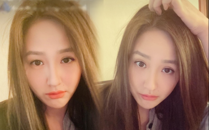 Mai Phương Thúy tiết lộ tóc bị rụng đến sắp hói Ảnh 2