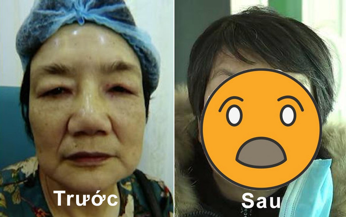 Chi 900 triệu đồng đi phẫu thuật thẩm mỹ, người phụ nữ bị chồng đuổi khỏi nhà vì tướng mạo dữ tợn Ảnh 2