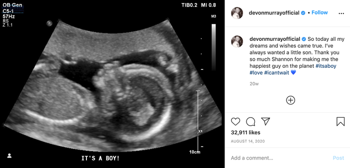 Hình ảnh đầu tiên của Cooper khi còn trong bụng mẹ