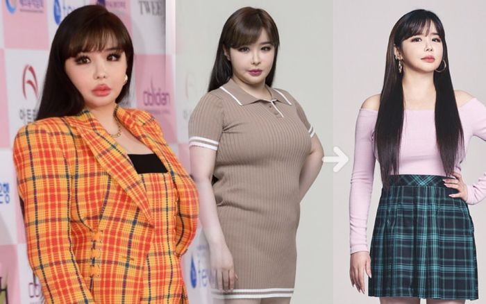 'Cô béo' Park Bom (2NE1) lột xác sau khi giảm 11kg: Mặt vẫn đơ như búp bê bị hỏng! Ảnh 2