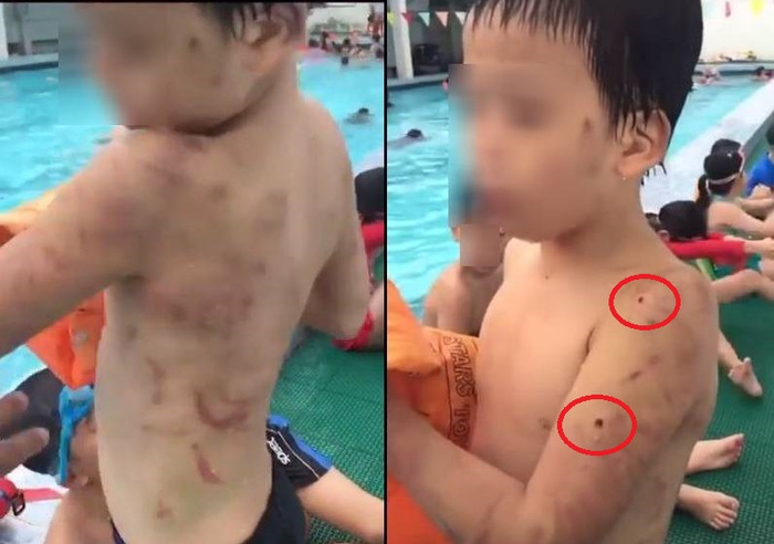 Nhiều vết sẹo, vết thủng trên tay, mặt, lưng của cậu bé khiến nhiều người bức xúc. Ảnh cắt từ clip. (Nguồn video: Minh Tiến)