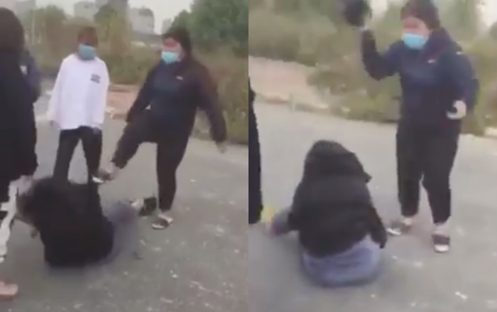 Nữ sinh 15 tuổi bị nhóm bạn đánh phải theo dõi chấn thương sọ não, rạn xương quai hàm Ảnh 3