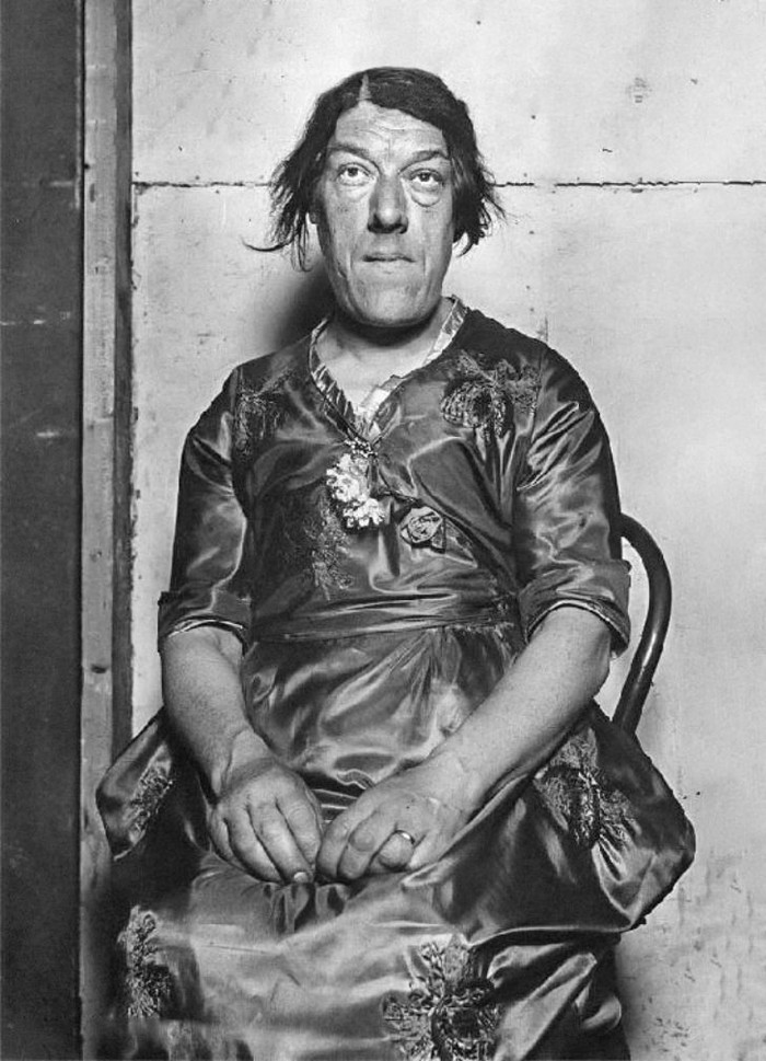 Chuyện cảm động về người phụ nữ xấu nhất thế giới phải 'bán mặt' để nuôi con Ảnh 5