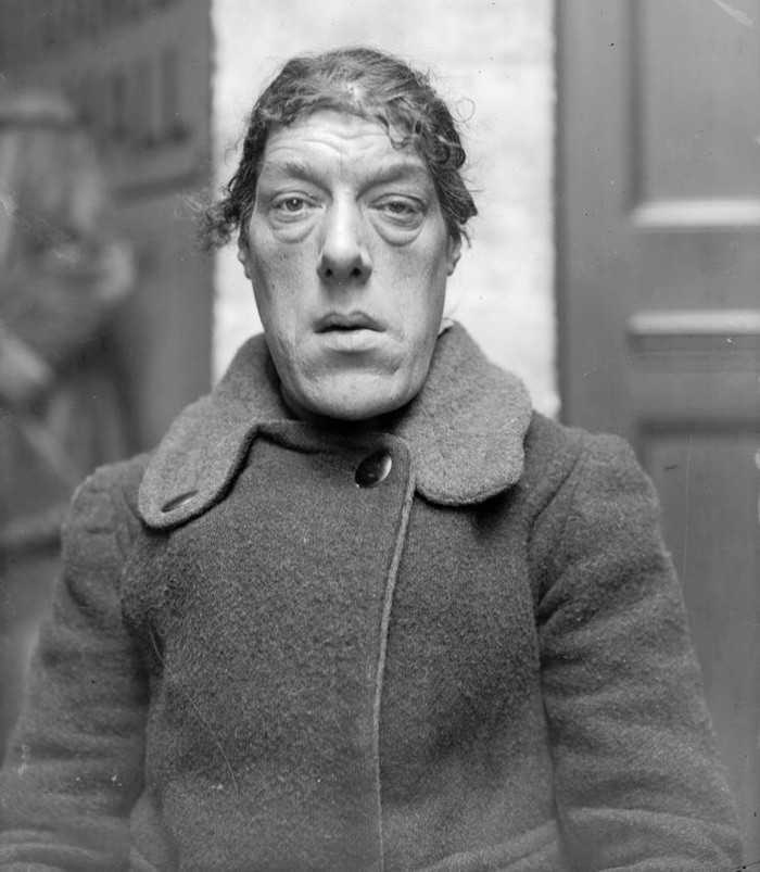 Chuyện cảm động về người phụ nữ xấu nhất thế giới phải 'bán mặt' để nuôi con Ảnh 4