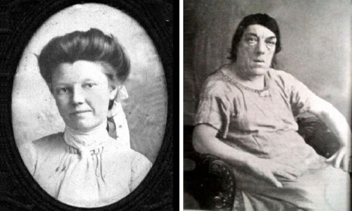 Chuyện cảm động về người phụ nữ xấu nhất thế giới phải 'bán mặt' để nuôi con Ảnh 3