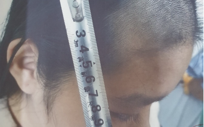 Khởi tố, bắt tạm giam người cha tra tấn con 15 tuổi dã man, dùng tông đơ đập vào đầu bất tỉnh Ảnh 2