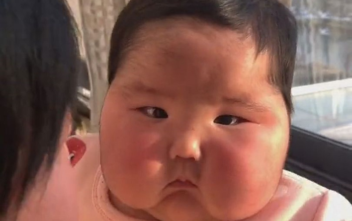 Thấy mặt con phình to gấp đôi, cha mẹ tá hỏa đưa tới bệnh viện và phát hiện ra sự thật đáng sợ Ảnh 2