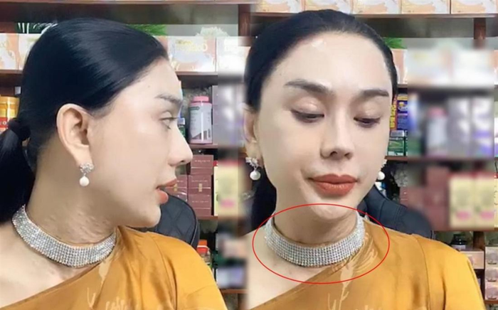 Lâm Khánh Chi lộ làn da cổ sần sùi nổi đầy hạt khi livestream Ảnh 2