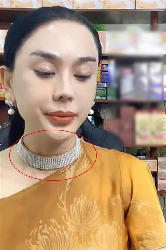 Lâm Khánh Chi lộ làn da cổ sần sùi nổi đầy hạt khi livestream Ảnh 2