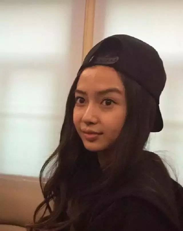 Angelababy lộ biến chứng phẫu thuật thẩm mỹ sau những tranh cãi với Huỳnh Hiểu Minh? Ảnh 12