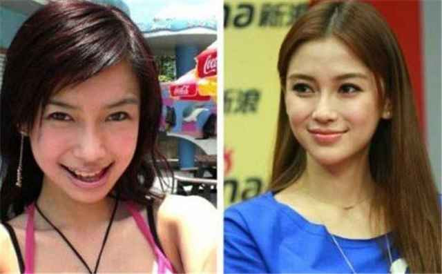 Angelababy lộ biến chứng phẫu thuật thẩm mỹ sau những tranh cãi với Huỳnh Hiểu Minh? Ảnh 11